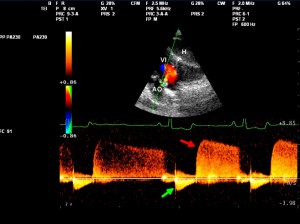 Cardiologie bij Paarden - Echocardiography