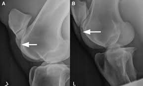 Osteochondrosis in horses