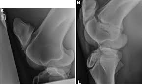 Osteochondrosis in horses